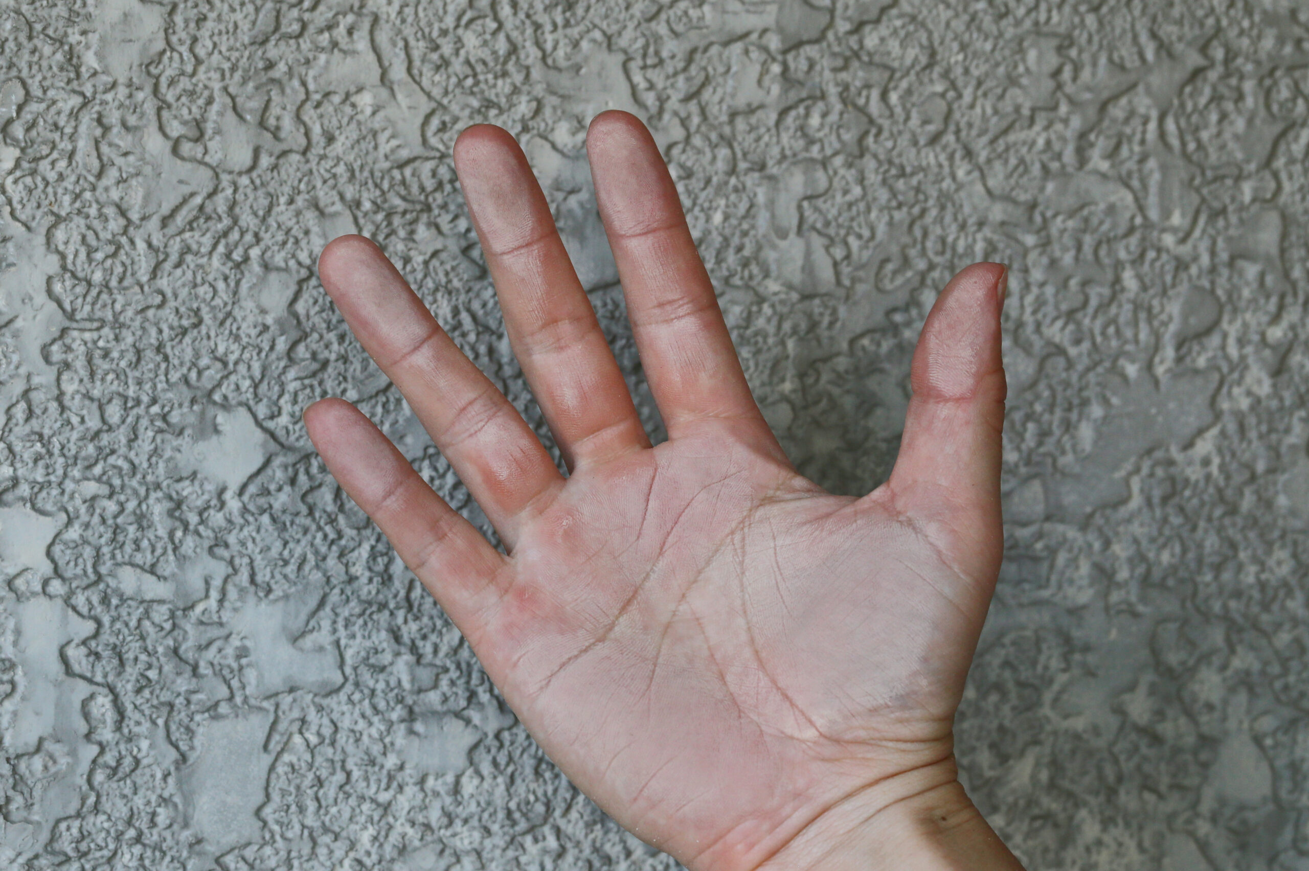 外壁のチョーキング